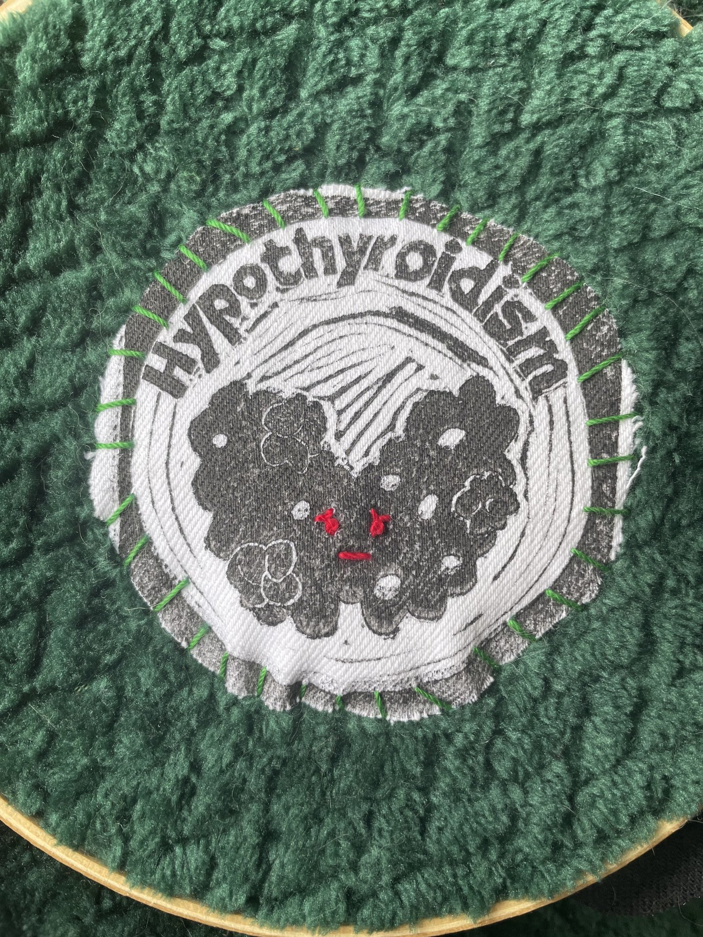 Hypothyroidism Patch