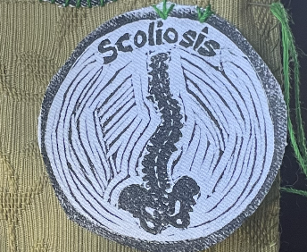 Scoliosis Patch